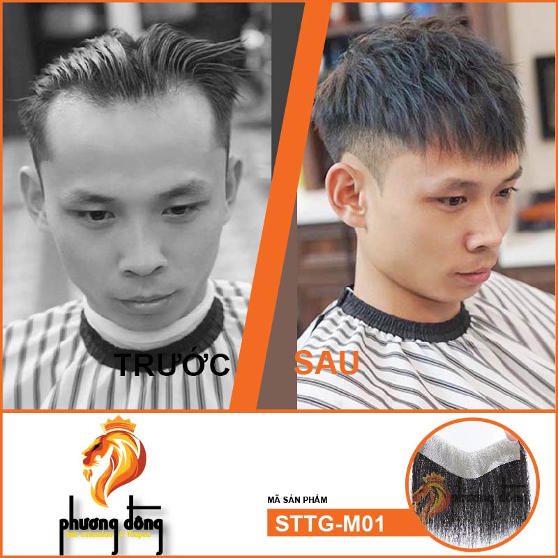 43 Kiểu Tóc Nam Cho Đầu Hói ý tưởng  kiểu tóc nam kiểu tóc tóc nam